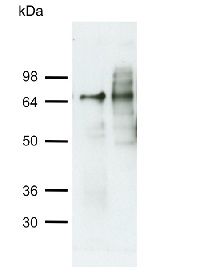 ATG4 | Autophagy protein 4 (algal) in the group Antibodies for Plant/Algal / Protein Modifications / Autophagy-related and Ubiquitin-like Proteins at Agrisera AB (Antibodies for research) (AS15 2831)